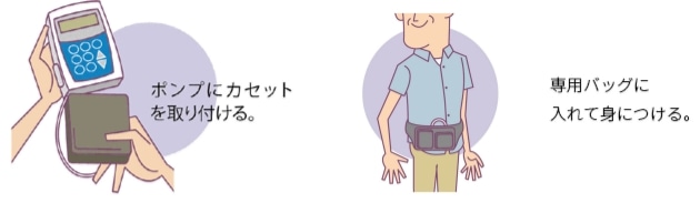 �J�Z�b�g�g�p�̃C���[�W�摜